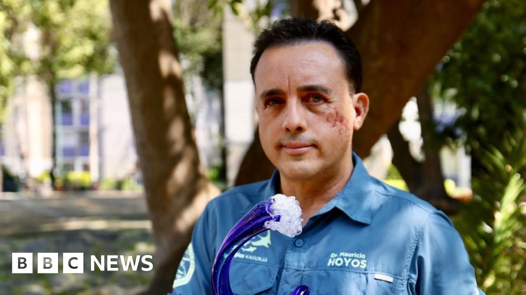 'This animal spared my life': Biologist bitten in head by shark hopes to meet it again