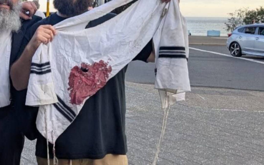 הסכנה הייתה כה מוחשית: כך ניתן היה למנוע את הפיגוע באוסטרליה | עו"ד אוריאל לין‎
