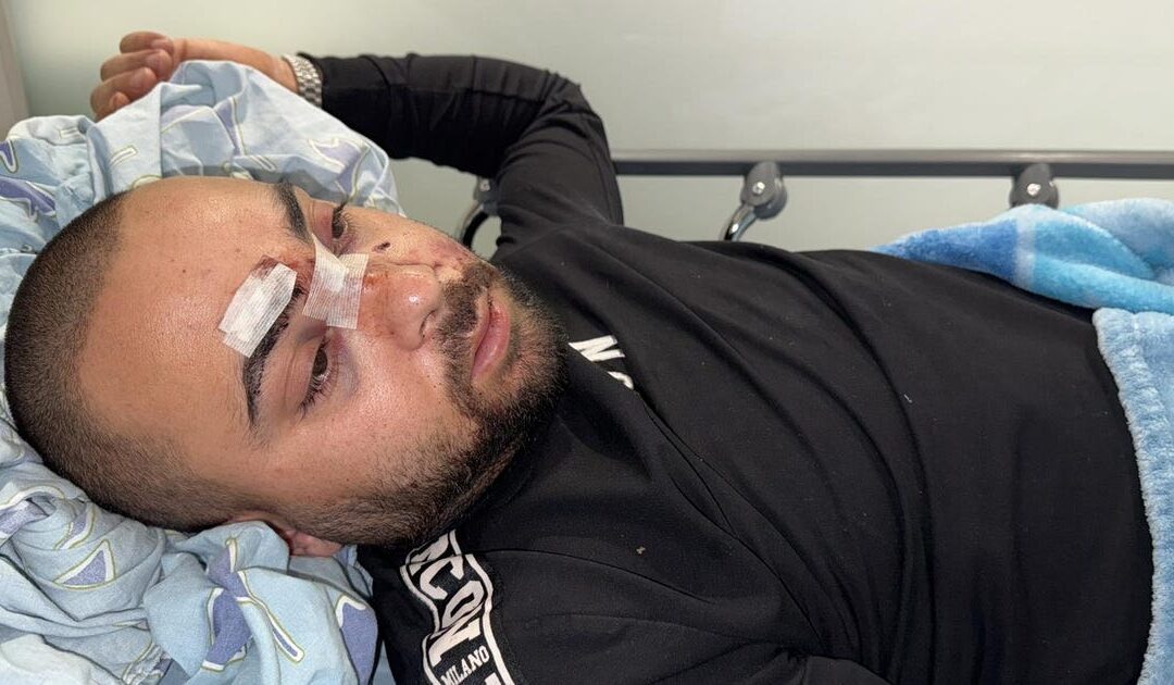 Israel Police release Jewish men who assaulted Arabs in Tel Aviv from house arrest