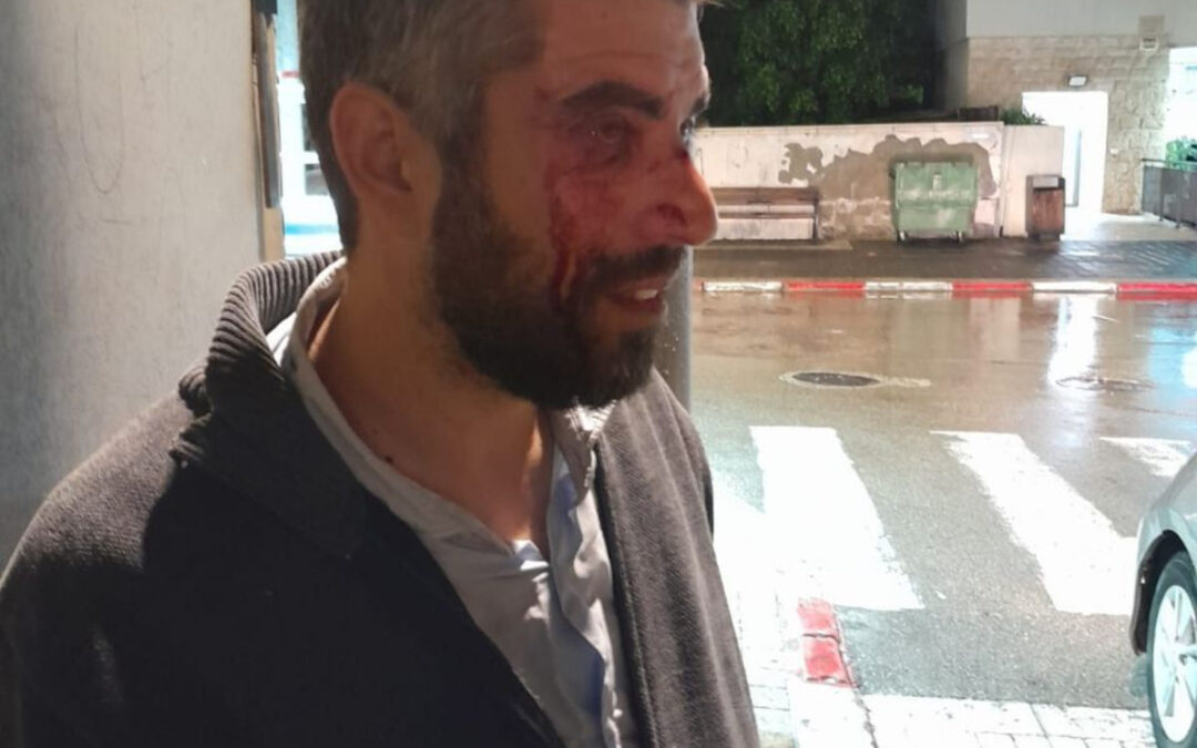 חשד לתג מחיר – רב הותקף ביפו: "חבט בו והפיל אותו על הרצפה"
