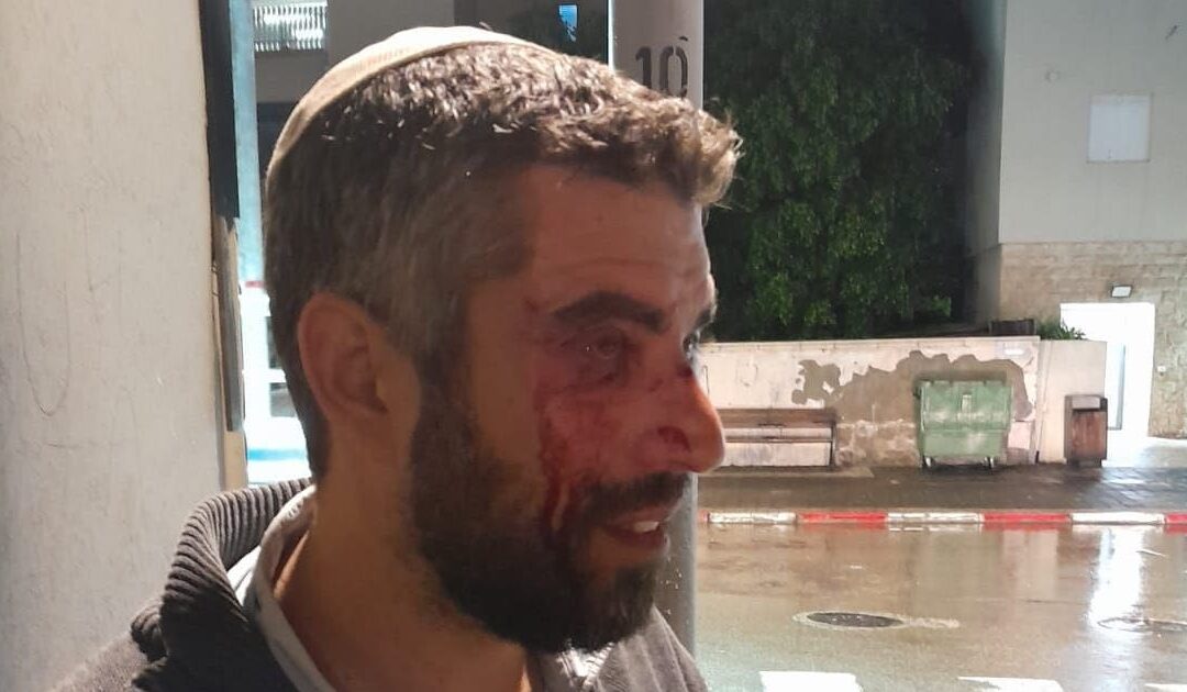 Rabbi from religious nationalist group attacked in Jaffa; police probing possible racial motive